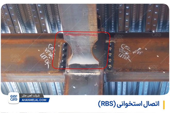 اتصال استخوانی (RBS)